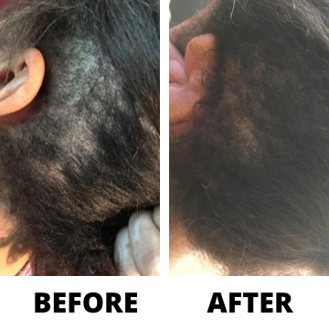 Three Bottles of Rennora EXTRA-Strength Hair Growth Serum - Image 4