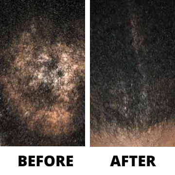 Rennora EXTRA-Strength Hair Growth Serum - Image 4