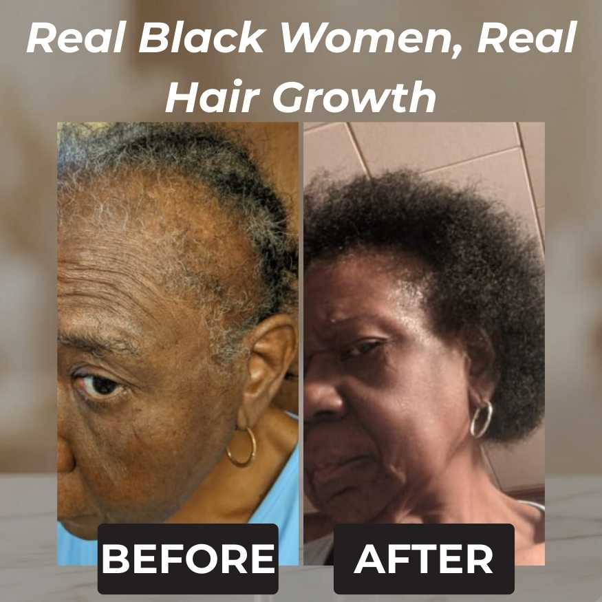 Rennora Hair Growth Serum - Image 4