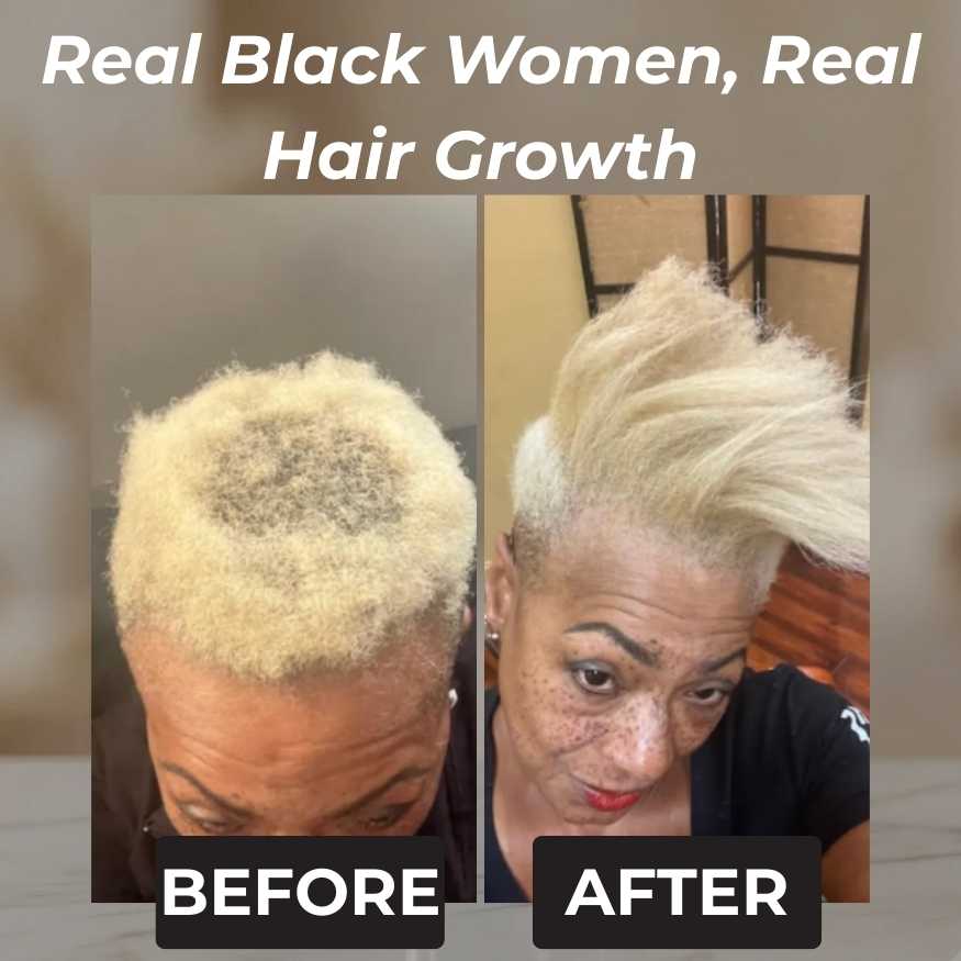 Rennora Hair Growth Serum - Image 5