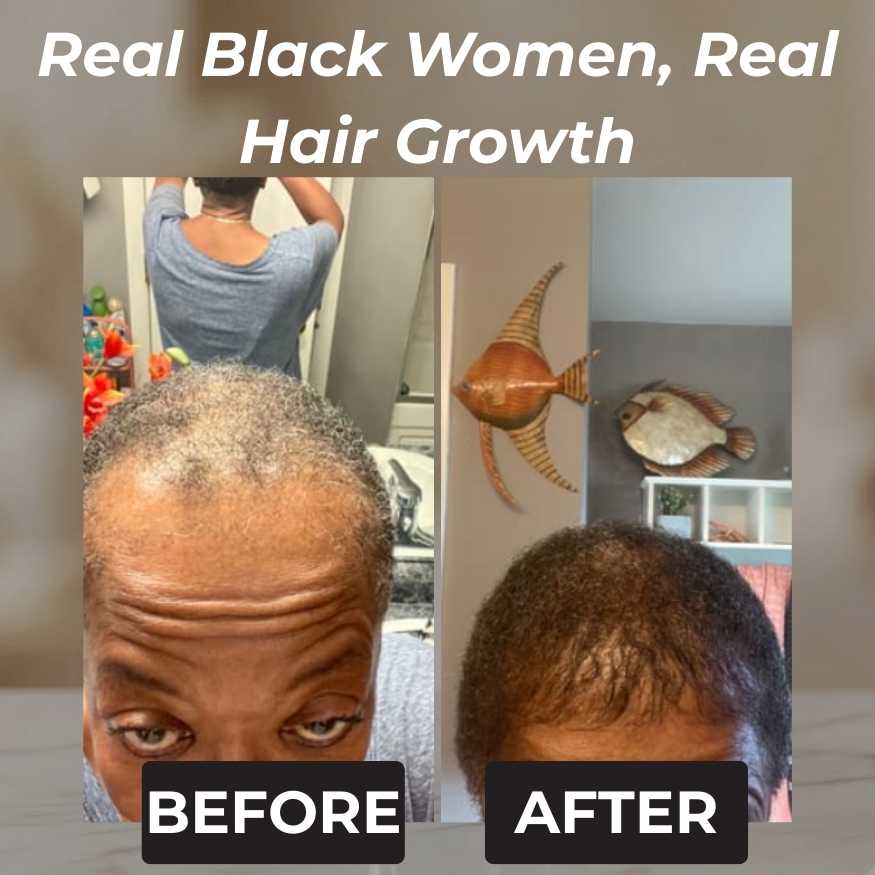 Rennora Hair Growth Serum - Image 6